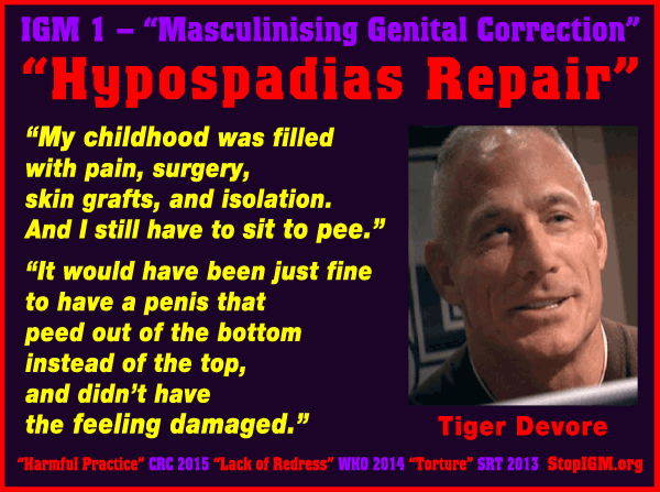 IGM1_Hypospadias-Repair_xb.png, Jun 2015